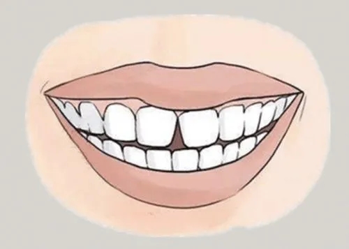 <a href=http://mkvu.com.cn/news_article?news_id=116>一次性口腔探針</a>